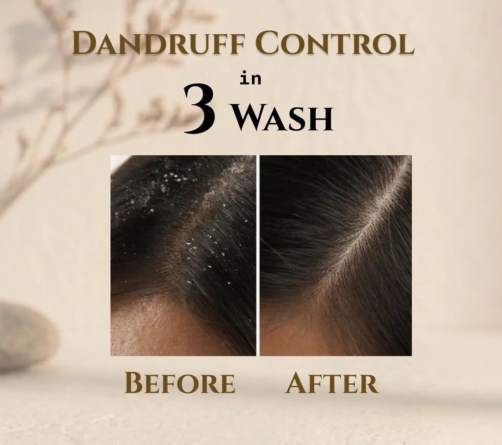 Zero: Anti Dandruff Hair Cleansing Ritual for Winters - Hair Cleansing Powder + Activation Serum